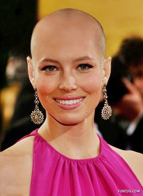 What If Your Favourite Celeb Go Bald?