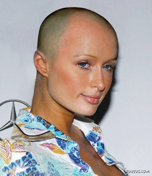 What If Your Favourite Celeb Go Bald?
