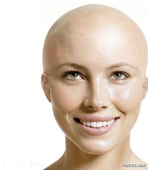 What If Your Favourite Celeb Go Bald?