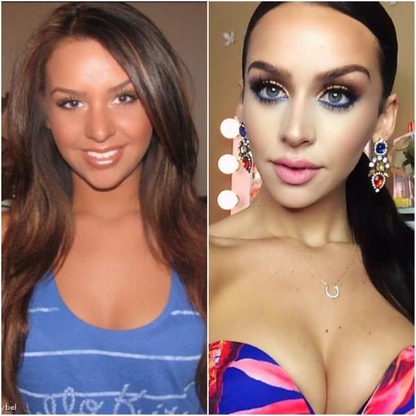 Re: 10 Popular Instagram Models Before And After Cosmetic Surgery.
